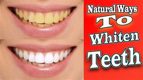 The Magic Solution: How Natural Teeth Whitening Can Boost Your Confidence